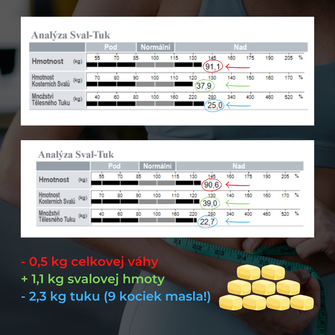 ☝️ Nenechajte sa odradiť prvotným zdanlivým neúspechom! Na obrázku vidíte dva výsledky merania klienta s odstupom 2 mesiacov. Ak by sme sledovali iba číslo na váhe, môžeme mať dojem, že klient schudol iba 0,5 kg a jeho snaženie nefungovalo. 🙄 Je to ale omyl. Ak sa pozriete poriadne, u klienta došlo k nárastu svalovej hmoty a zároveň schudol skvelých 2,3 kg tuku. Môžete si to predstaviť ako 9 kociek masla. 🧈 A tento výsledok sa mu podarilo dosiahnuť len vďaka obmedzeniu sladkostí a zaradeniu pohybu do života. 💪
Pokiaľ aj vy chcete zistiť ako na tom ste a čo presne sa deje s vaším telom, objednajte sa na InBody meranie. Takéto presné výsledky vám totiž obyčajná váha či diagnostická váha z Lidl neukáže. 😉
Ak máte záujem iba o meranie, termín si môžete rezervovať počas celého týždňa, meranie s interpretáciou výsledkov si rezervujte na víkend. ⚖ Najlepšie je dať si ranný termín a prísť nalačno. 🍳❌
📩 Rezervujte si meranie - napíšte nám sem do správy, poprípade nám môžete zavolať +421 918 223 533 alebo napísať mail info@fithub.sk
Viac info nájdete na našom webe 👉 https://fithub.sk/sluzby/inbody-230/
#fithub #fitness #inbody #meranie #vysledky #ciel #zdravie #cachtice #novemestonadvahom #workout #progres